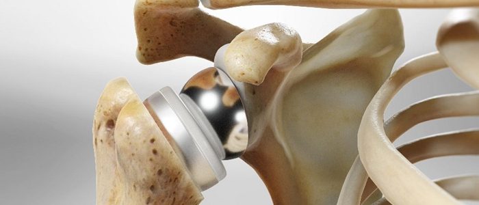 Orthopaedic Surgery